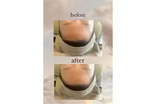 crescent所属・【韓国肌管理・脱毛】 クレセントのその他イメージ