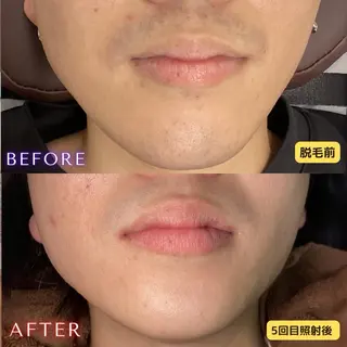 メンズ 都度払い専門　脱毛サロンHYGIENE BEAUTY ROOM 19B 仙台駅前東口店所属・脱毛サロン 19B(毛利)のエステ・リラクイメージ