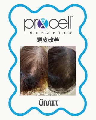 Ümit（ユミト） プロセルセラピーズのネイルデザイン