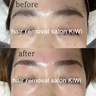 アイブロウ 脱毛サロン KiWiのエステ・リラクイメージ