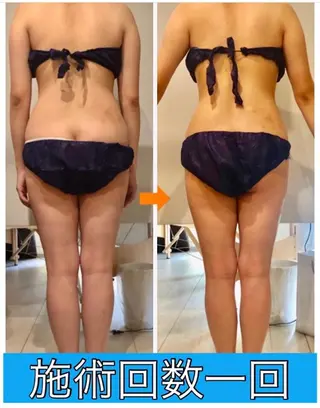 ショート カラー パーマ ヘアアレンジ メンズ キッズ ネイル マツエク・マツパ ‍痩身＆ボディ 結果出し🌟丹野のエステ・リラクイメージ