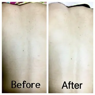 川越ローマピンク 光脱毛＆ワックス脱毛のエステ・リラクイメージ