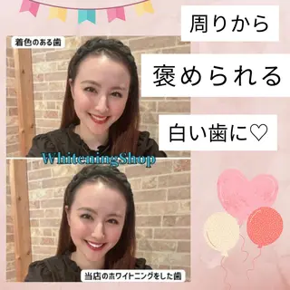 ホワイトニング ショップ葛西店のその他イメージ