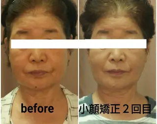 小顔と美肌 まごころエステMatoria所属・小顔 美肌専門 Matoriaのエステ・リラクイメージ