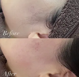 Cheri所属・丸山 彩乃のエステ・リラクイメージ