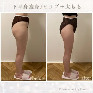 Lily branc 痩身/小顔/肌質改善のエステ・リラクイメージ