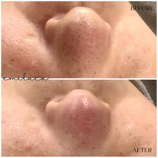 EMILUCA 伊藤のエステ・リラクイメージ