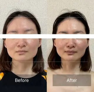 小顔＆肌質改善　お顔の印象所属・小顔×肌質改善 《お顔の印象》のエステ・リラクイメージ