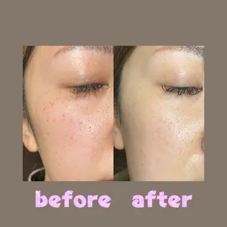 加藤 千鈴のネイルデザイン