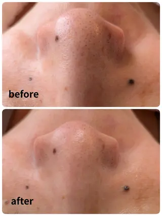 A.Nails salonのエステ・リラクイメージ