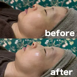 肌質改善 陶器肌🌿のエステ・リラクイメージ