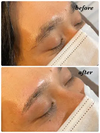 アイブロウ ハーブピーリング/韓国肌管理/フェイシャル/毛穴洗浄/眉毛/顔脱毛【糸脱毛専門】rev所属・ハーブピーリング🌹 毛穴洗浄❤️眉waxのエステ・リラクイメージ