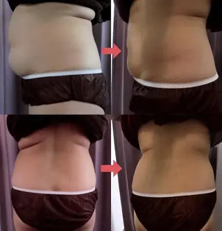 横浜エステサロン R-ing　リングのエステ・リラクイメージ