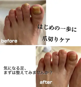 巻き爪フットケアサロンKotori所属・フットケアサロン Kotoriのその他イメージ