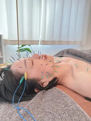 美容鍼＆鍼灸サロン 鍼Glitter.所属・田中 美奈のエステ・リラクイメージ