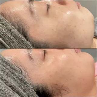 LiZA エステティックサロンのエステ・リラクイメージ