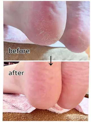 セミロング ネイル Rubynail所属・プライベートサロン Rubynailのネイルデザイン