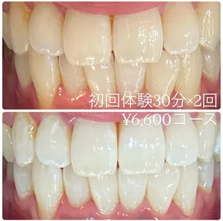 PLATINUM Beauty 横浜店所属・ホワイトニングルーム 横浜店のその他イメージ