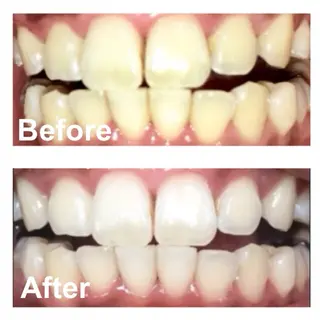 KalanDiva〜 ｶﾗﾝﾃﾞｨｰﾊﾞ〜のエステ・リラクイメージ