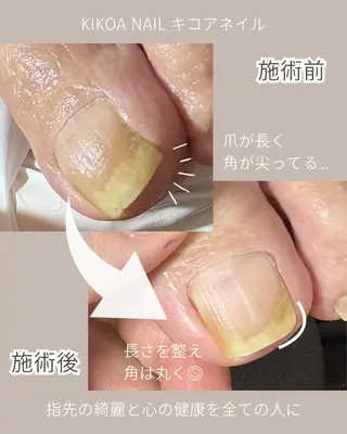 ネイル KIKOA NAIL キコアネイルのネイルデザイン