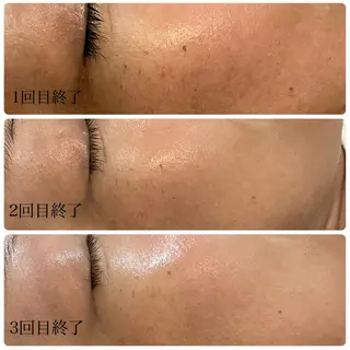 温活美肌専門サロン Lien『リアン』のエステ・リラクイメージ