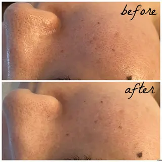 メンズ メナード岐阜市茜部 杉浦のエステ・リラクイメージ