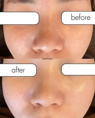 南森町・肌質改善 BELMIMARのエステ・リラクイメージ