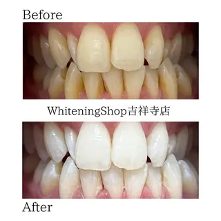 ホワイトニング ショップ吉祥寺店のエステ・リラクイメージ