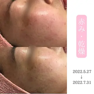 肌質改善サロン BestBelleのエステ・リラクイメージ