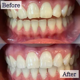 LBSホワイトニング 新宿店💝公式のその他イメージ