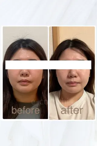 小顔と ヘッドスパのお店のエステ・リラクイメージ