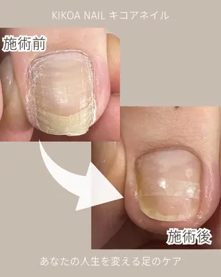 ネイル KIKOA NAIL キコアネイルのネイルデザイン