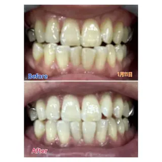 MBEAUTYSALON 千葉店・京成大久保所属・Melty 輝のその他イメージ