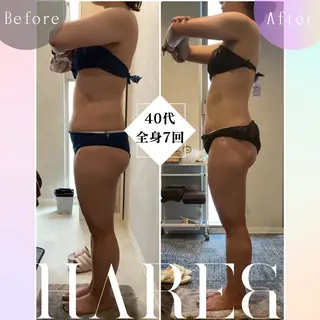 Hare&所属・川西エステサロン Hare&のエステ・リラクイメージ