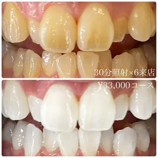 PLATINUM Beauty 横浜店所属・ホワイトニングルーム 横浜店のその他イメージ