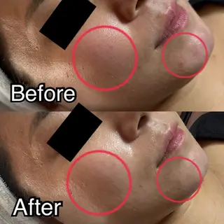 ROR所属・ROR nailのエステ・リラクイメージ