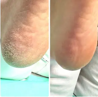 巻き爪補正店 松戸店のネイルデザイン