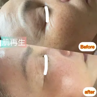 La BeIIe vie所属・LaBeIIevie ラベルヴィのマツエク・マツパデザイン