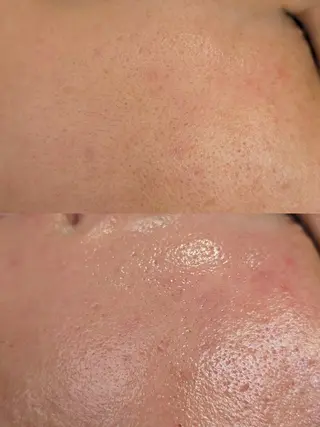 Morphome所属・【Morphome】 hinaのエステ・リラクイメージ