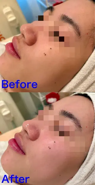 Fulala 永田のエステ・リラクイメージ