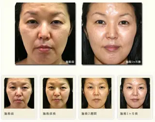 鹿野 記子のエステ・リラクイメージ