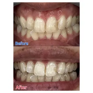 MBEAUTYSALON 千葉店・京成大久保所属・Melty 輝のその他イメージ