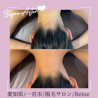 Reine BeautySalon所属・毛穴/シミ肝斑/脱毛 横山梨里のエステ・リラクイメージ