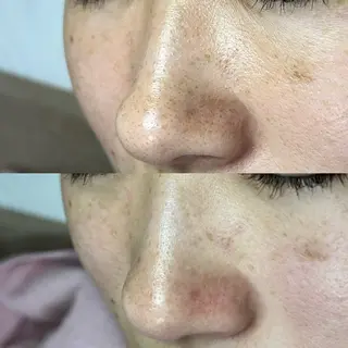 毛穴ケア・ヘッドスパサロンSHINY(シャイニー)所属・毛穴ケア・ヘッドスパ サロンSHINYのエステ・リラクイメージ