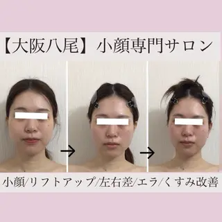 リフトアップ小顔 専門のエステ・リラクイメージ