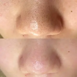 毛穴専門店MeMe.八千代店所属・\毛穴・頭皮/ のお悩みに特化💪のその他イメージ