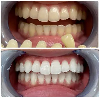 cona whitening神保町所属・ホワイトニング 神保町店/杉浦のエステ・リラクイメージ