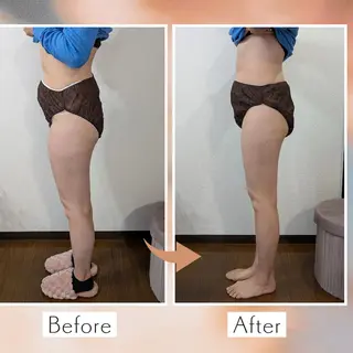 【痩身▪️体質改善ダイエット】美養サロンEnbi～縁美～所属・美養サロンEnbi ～縁美～のエステ・リラクイメージ