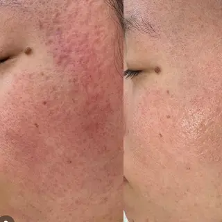 美肌蘇生カウンセラー 横山りえのエステ・リラクイメージ