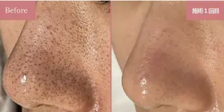 レイフィールド江南店所属・レイエステティック 江南店のエステ・リラクイメージ